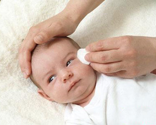 Trị ghèn mắt cho bé sơ sinh
