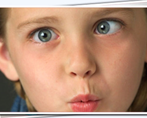 Phát hiện sớm lác ở bé