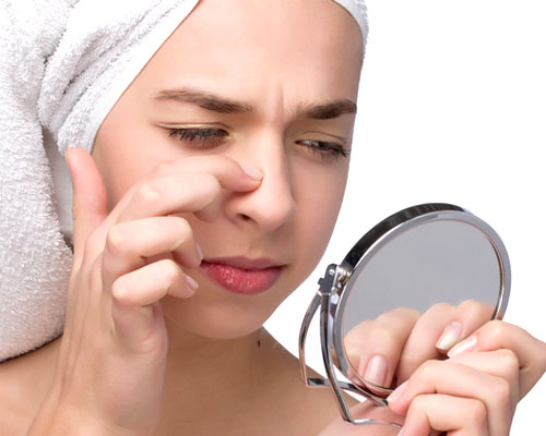 Trị mụn cám ở mũi